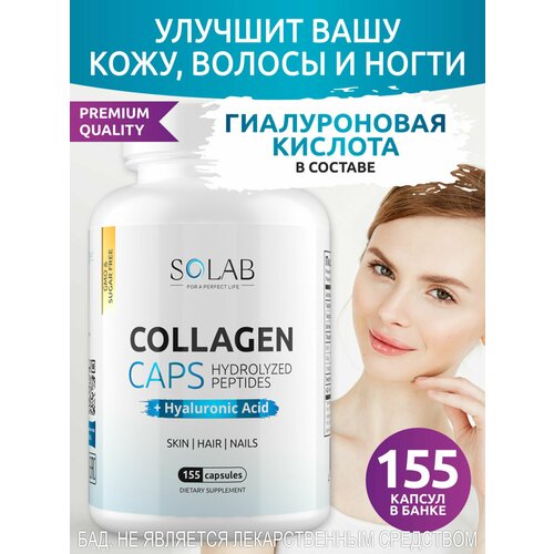  SOLAB          155    -     , -  