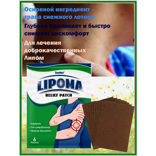 ���� �������� �� ������, ������ ������